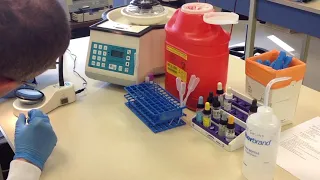 Direct Antibody Test