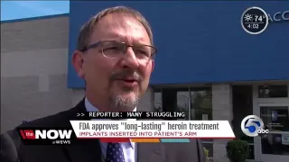 26044 Mensch WEWS FDA approves implant to combat heroin epidemic