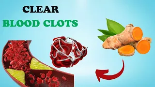 If You Want To Dissolve Blood Clots, Pay Attention To These 6 Vitamins | Healthy Care
