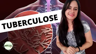 Tuberculose (Aula completa) - Profa. Juliana Mello