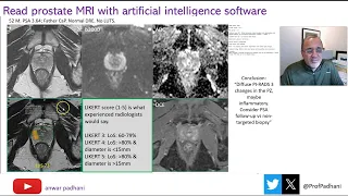 Reading Prostate MRI with AI Software Assistance