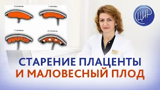 Старение плаценты, маловесный плод и Кардиомагнил в 30 недель. Дементьева С.Н.