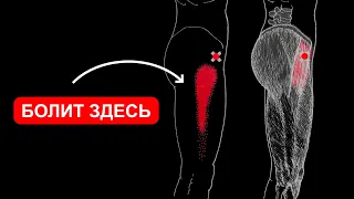 БОЛИТ БОКОВАЯ ПОВЕРХНОСТЬ БЕДРА И ТАЗОБЕДРЕННЫЙ СУСТАВ 🔴 НАПРЯГАТЕЛЬ ШИРОКОЙ ФАСЦИИ БЕДРА