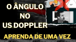 Aprenda de uma vez por todas a corrigir o ÂNGULO nos exames de Doppler