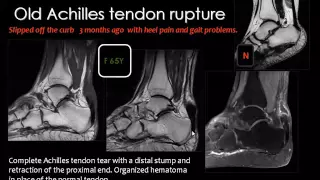 Imaging of ankle joint jordan Aug 2014   Dr Mamdouh Mahfouz In Arabic