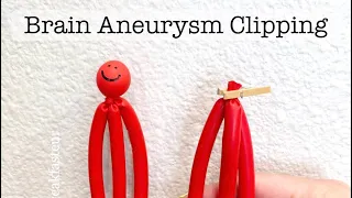 Playdough Surgery 🔪🧠🍒 - Brain Aneurysm Clipping