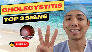 Top 3 signs of cholecystitis. And what to do about it.