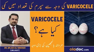 Varicocele Treatment In Urdu/Hindi - Mardana Banjhpan Ki Wajah - Varicocele Ka Ilaj - Sperm Men Kami