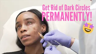 Get rid of dark circles FOR GOOD! no makeup required!