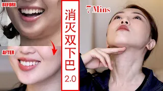 【How to Get Rid of Double Chin 2.0 】5 Easy Face Exercises for Double Chin Removal  
