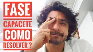 COMO RESOLVER A FASE CAPACETE FASE CHATA,  DEIXANDO O CABELO CRESCER MASCULINO