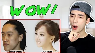 Korean Plastic Surgery Before and After Photos Reaction