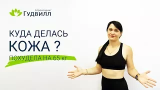 Куда делась кожа после похудения?