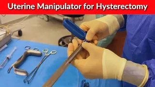 Uterine manipulator for hysterectomy