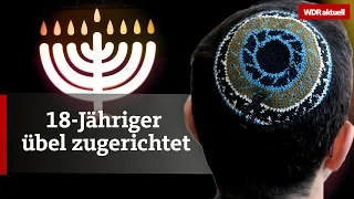 Antisemitischer Angriff in Köln: Zehn Leute gehen auf Kippa-Träger los | WDR Aktuelle Stunde