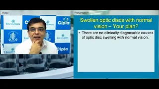 #Live_Webinar - Approach to Disc Edema and Disc Atrophy : - Dr Navin Jaykumar