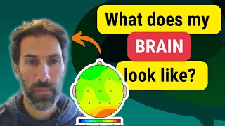 Inside the Autistic Brain – THE RESULTS ARE IN!