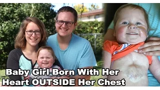 The Miracle Baby Girl Born With Her Heart OUTSIDE Her Chest