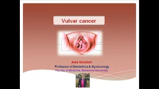 Vulvar cancer