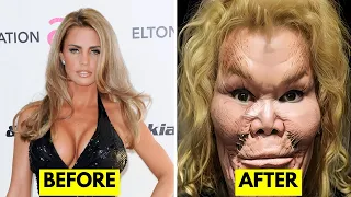 25 Celebrity Plastic Surgery Disasters