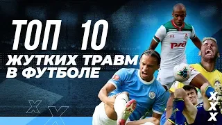 ТОП 10 САМЫХ ЖУТКИХ ТРАВМ В ФУТБОЛЕ