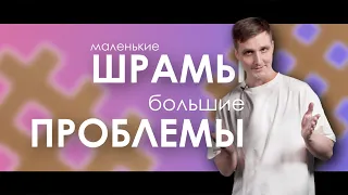 ОБРАЩАЙ ВНИМАНИЕ НА МАЛЕНЬКИЕ ШРАМЫ | Кирилл Копыльцов