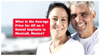 What is the Average Price for All on 4 Dental Implants in Mexicali, Mexico?