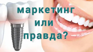 МГНОВЕННАЯ имплантация зубов. Быстрая ИМПЛАНТАЦИЯ зубов.