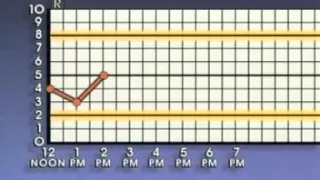 Statistical Process Control Basic Control Charts