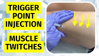 Trigger Point Injection Twitches / Dry Needling Twitch Response