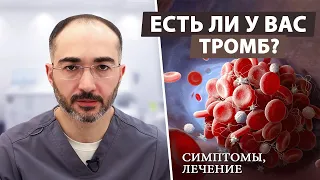 Как заподозрить у себя тромбоз и что потом делать?