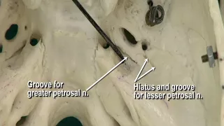 1.14 Step 22.  Petrosal nerves