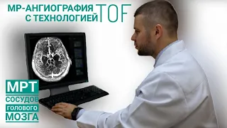 МРТ сосудов головного мозга (МР-ангиография с технологией TOF)