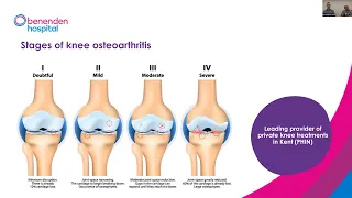 Benenden Hospital webinar: Treatment for knee osteoarthritis