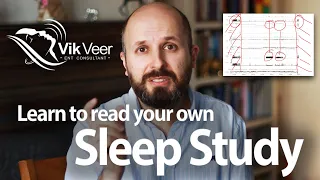 Why the AHI result is often wrong! Learn to read your sleep study correctly.