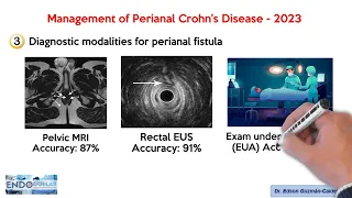 Management of Perianal Crohn's Disease - 2023