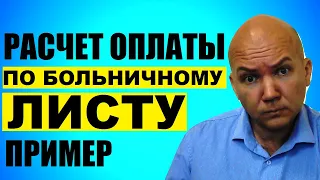 Как правильно рассчитать оплату больничного листа работнику онлайн. Калькулятор 2020 бесплатно