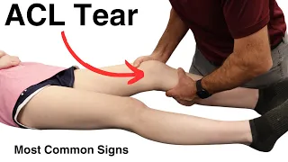 Signs Of An ACL Tear: What You Need To Know!