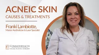 Acneic Skin: Causes & Treatments