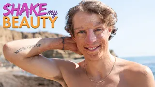 75% Of My Body Is Burnt | SHAKE MY BEAUTY