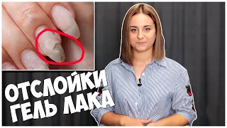 ПОЧЕМУ ГЕЛЬ ЛАК НЕ ДЕРЖИТСЯ НА НОГТЯХ. 7 ОСНОВНЫХ ПРИЧИН ОТСЛОЙКИ ГЕЛЬ ЛАКА.