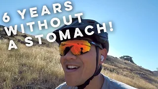 6 Years without Stomach: A Day in the Life