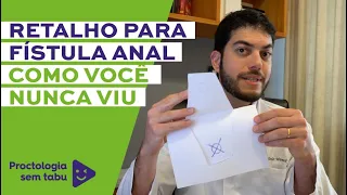 Retalho para fístula anal como você nunca viu! Agora você vai entender o que é a cirurgia de retalho