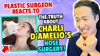 Plastic Surgeon Reacts to CHARLI D'AMELIO's Nose Surgery! - Dr. Anthony Youn