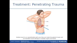 Soft Tissue Injuries for the EMT