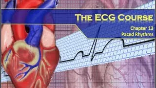 The ECG Course - Paced Rhythms