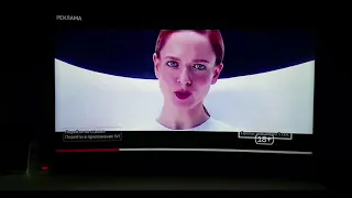 установка Forkplayer на любой smart tv