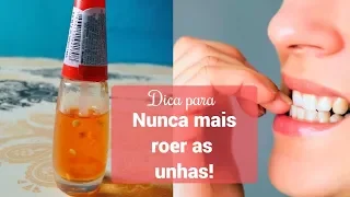 Dica para nunca mais roer as unhas