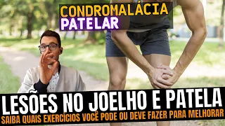 Condromalácia patelar Quais exercícios pode ou deve fazer e como tratar