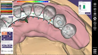 EXOCAD Моделировка Балки на трёх опорах